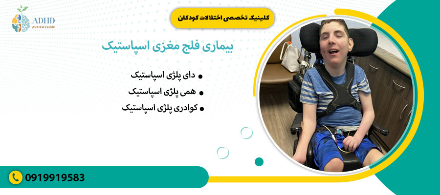 بیماری فلج مغزی اسپاستیک